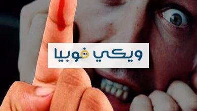 اعراض فوبيا الدم