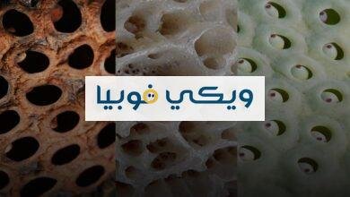 سبب مرض رهاب النخاريب