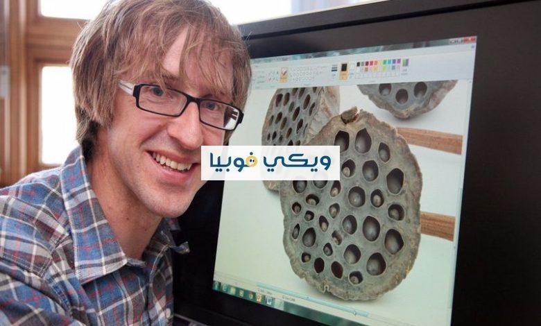 كيفية التخلص من فوبيا الثقوب أسباب وأعراض وعلاج كيفية التخلص من فوبيا الثقوب