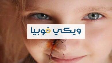 ألطفها فوبيا الفراشات.. تعرّف على أشهر أنواع الفوبيا اللطيفة أنواع الفوبيا اللطيفة