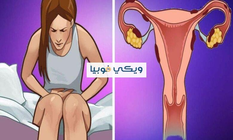 علامات فوبيا الدورة الشهرية | علاج رهاب الحيض ونصائح مهمة فوبيا الدورة الشهرية