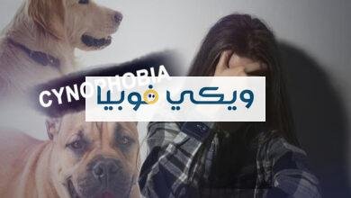 كيف تتخلص من فوبيا الكلاب