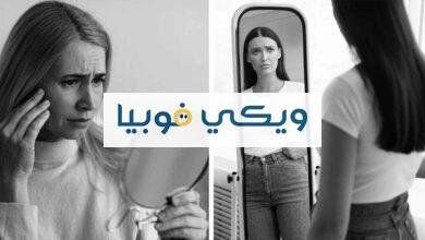 اضطراب التشوه الجسمي