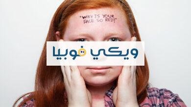 هل احمرار الوجه مرض نفسي